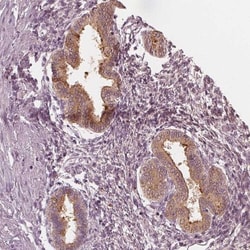 PP14/Glycodelin Antibody, Novus Biologicals:Antibodies:Primary Antibodies
